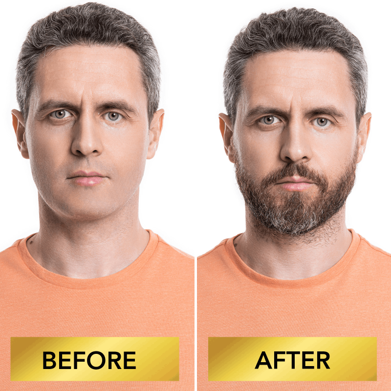 SEFUDUN sérum barbe + rouleau 0.25mm - Helloprice