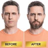 SEFUDUN sérum barbe + rouleau 0.25mm - Helloprice